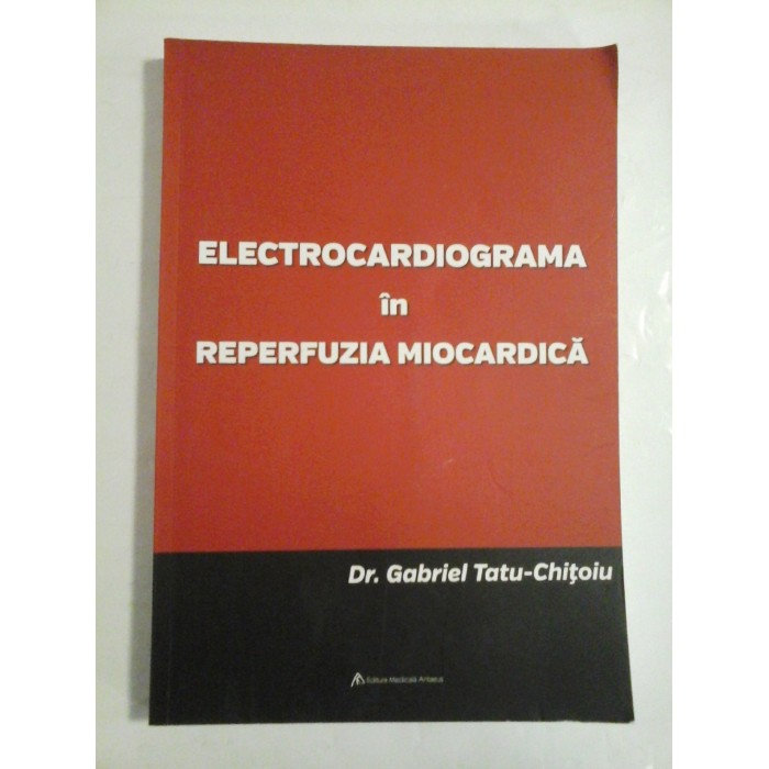 ELECTROCARDIOGRAMA in REPERFUZIA  MIOCARDICA  -  Gabriel Tatu - Chitoiu 